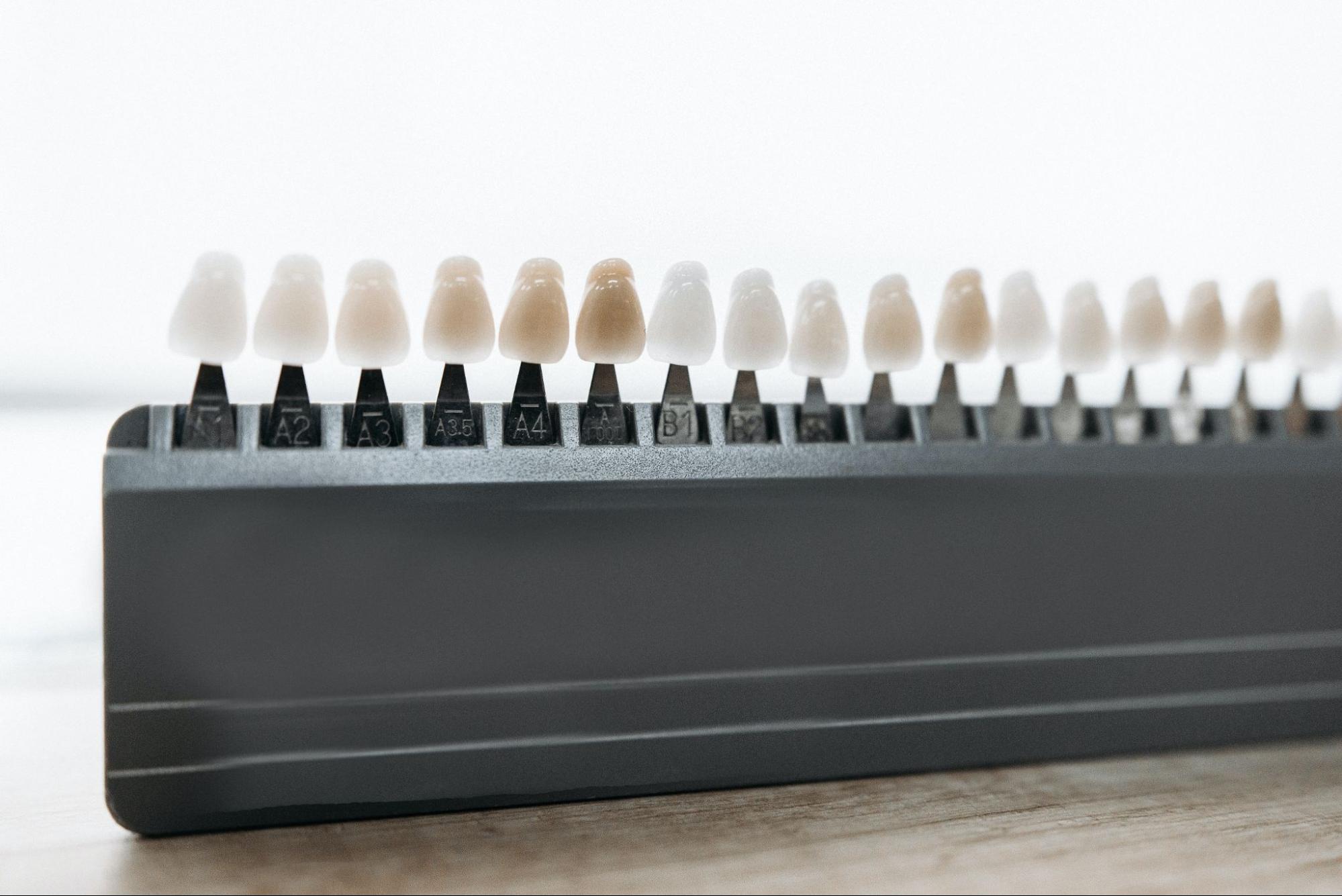 How Long Do Veneers Last? Comparing Porcelain & Composite