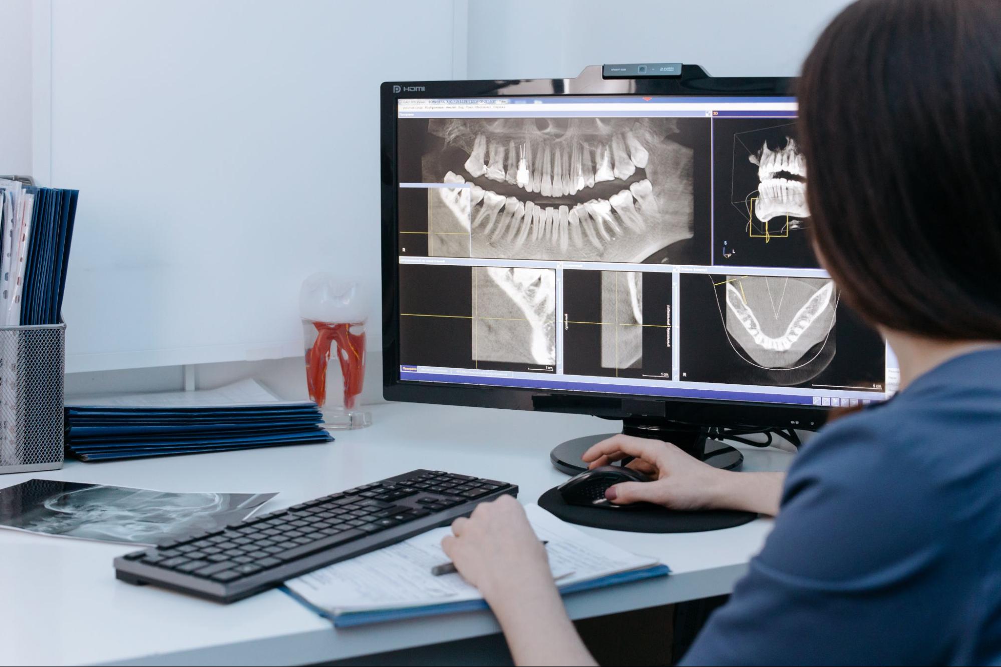 Can Veneers Fix Crowded Teeth?