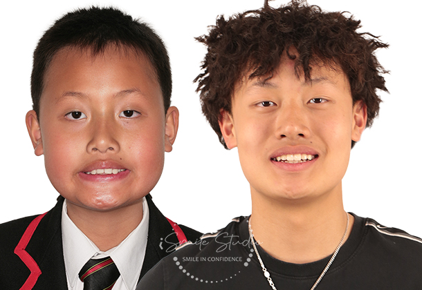 Before After