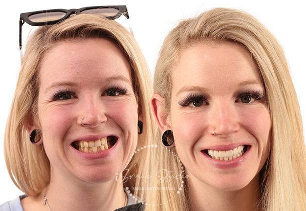 Before After