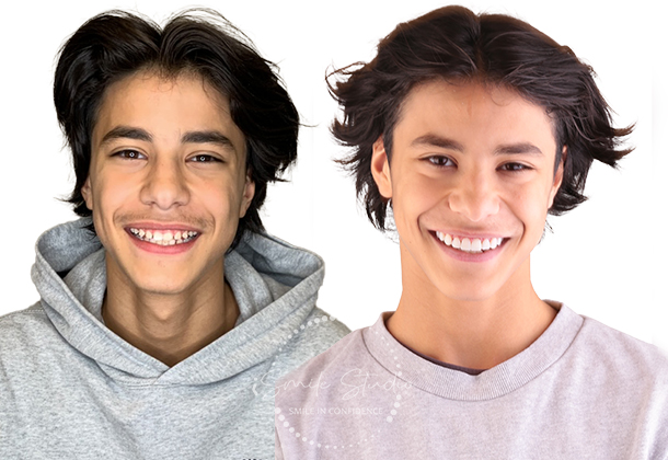 Before After