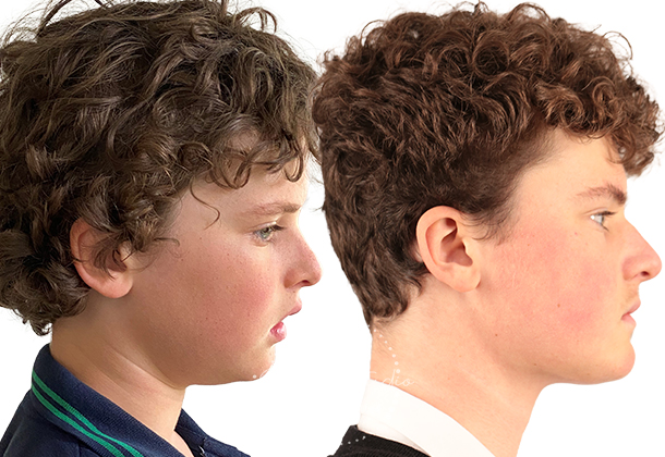Before After
