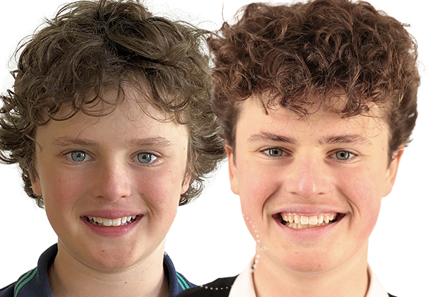 Before After