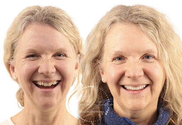 Before After