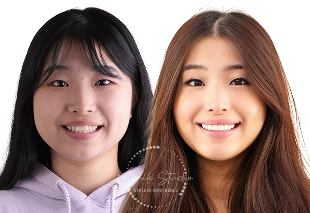 Before After