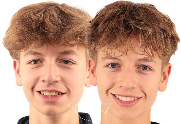 Before After