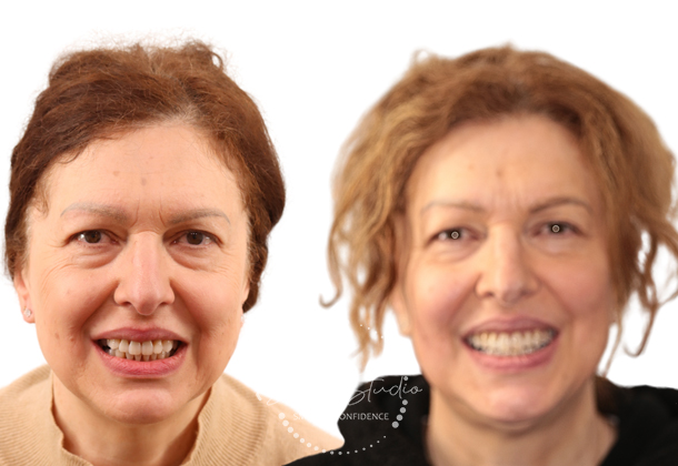 Before After