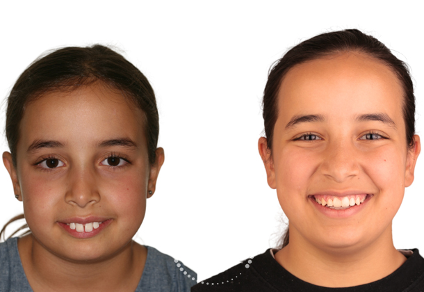 Before After