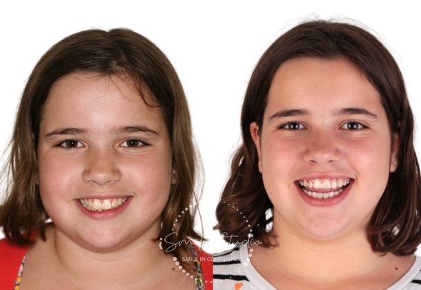 Before After